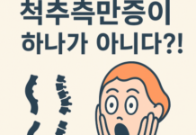 “척추측만증은 모두 다릅니다”