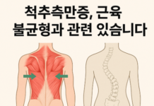 척추가 휘는 것이 아니라, 근육이 좌우를 다르게 당기고 있었다